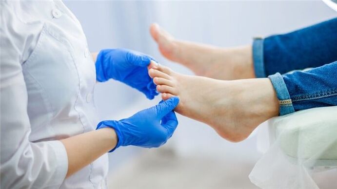 sintomas de fungo nos pés