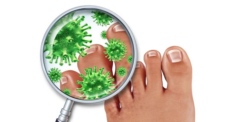 Unhas infectadas com um fungo