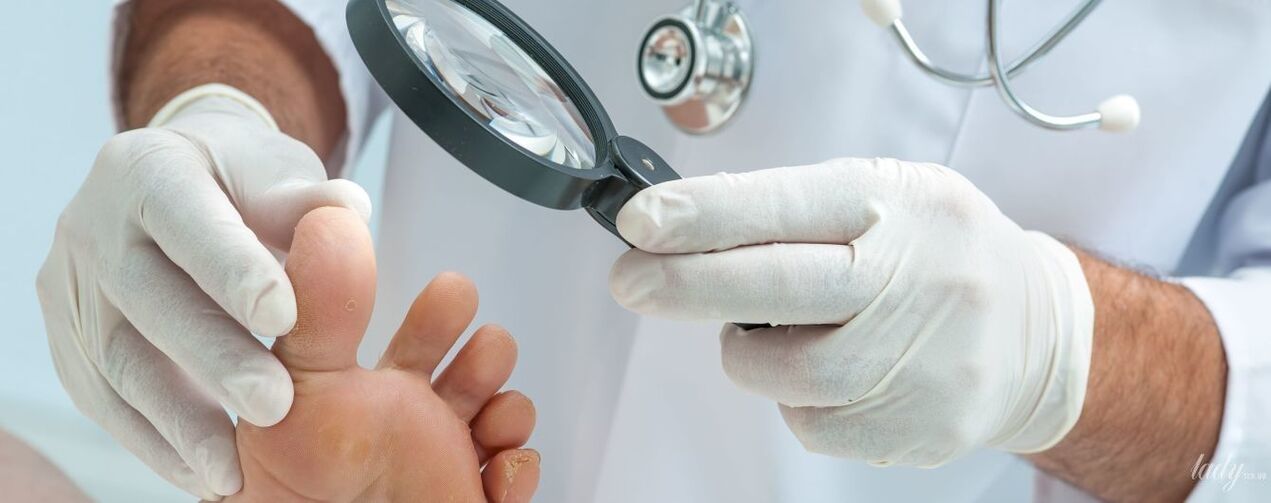 O médico examina o fungo no dedo do pé