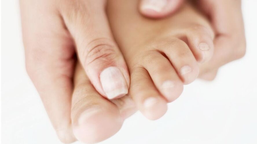coceira devido a fungos nas unhas do dedão do pé